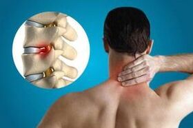 Fai clic sulle vertebre