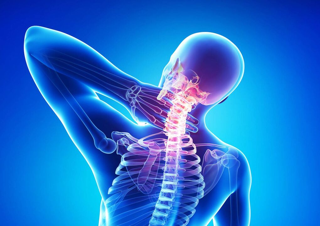 Osteocondrosi del collo