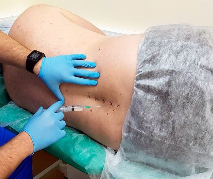 Blocchi medici per la schiena