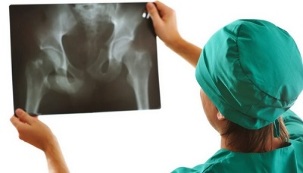 diagnosi strumentale dell'osteoartrosi dell'articolazione dell'anca