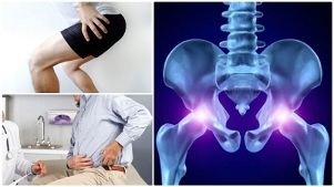 Classificazione dell'osteocondrosi della colonna vertebrale