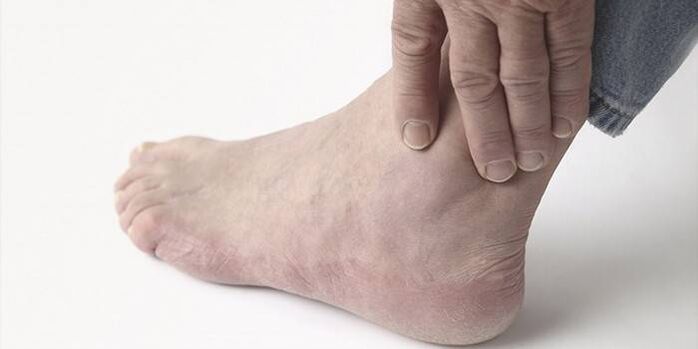 Dolore da artrosi della caviglia